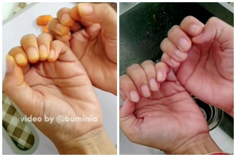 Bukan diolesi baking soda, ini cara cepat hilangkan noda kunyit di tangan pakai 1 bahan&nbsp;sederhana